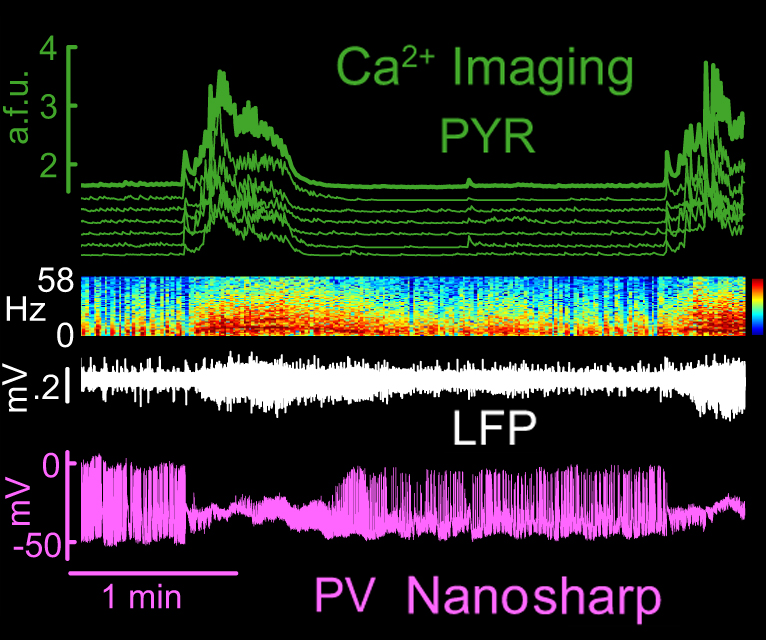 recording_ca_lfp_sharp_fig_cut2